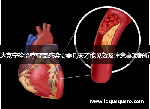 达克宁栓治疗霉菌感染需要几天才能见效及注意事项解析